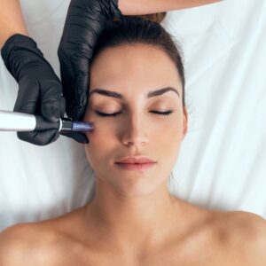Mesoterapia